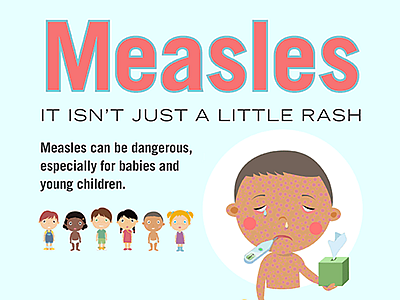 Measles - It isn't just a little rash